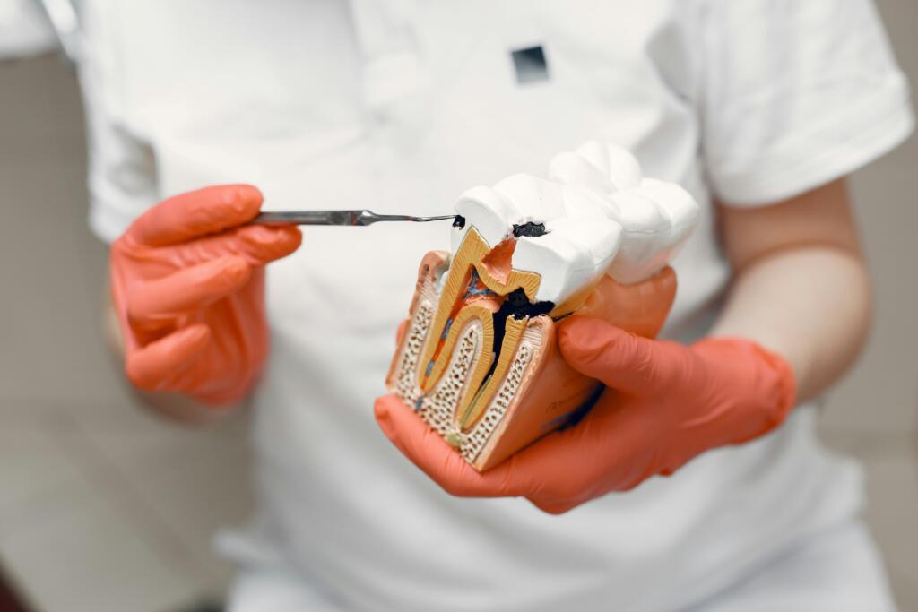Dentist demonstrating tooth decay on a dental model
