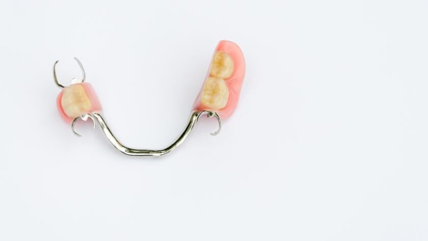 Partial denture, which may be used in lieu of dental implants