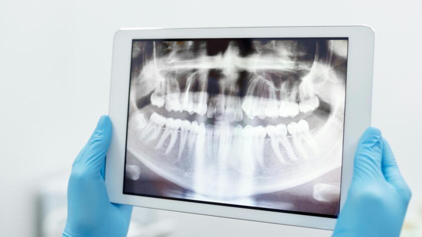 Dentist reviewing panoramic dental X-ray for treatment planning